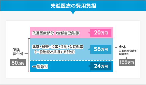 先進医療の費用負担