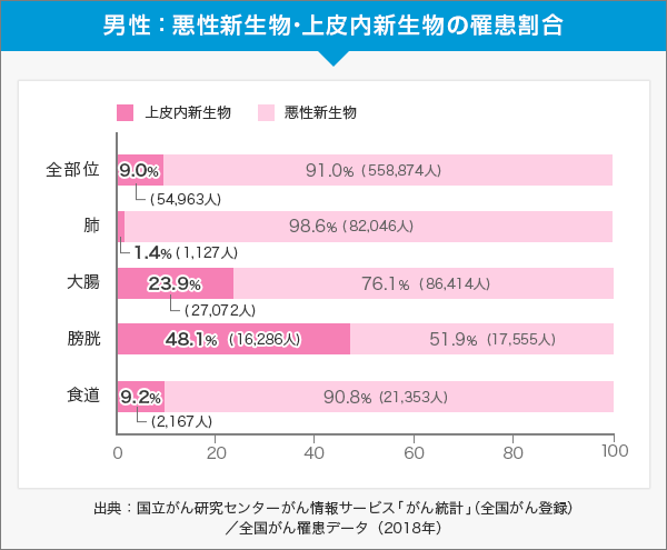 男性のがん罹患部位