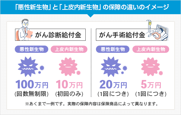 悪性新生物と上皮内新生物の保障の違い